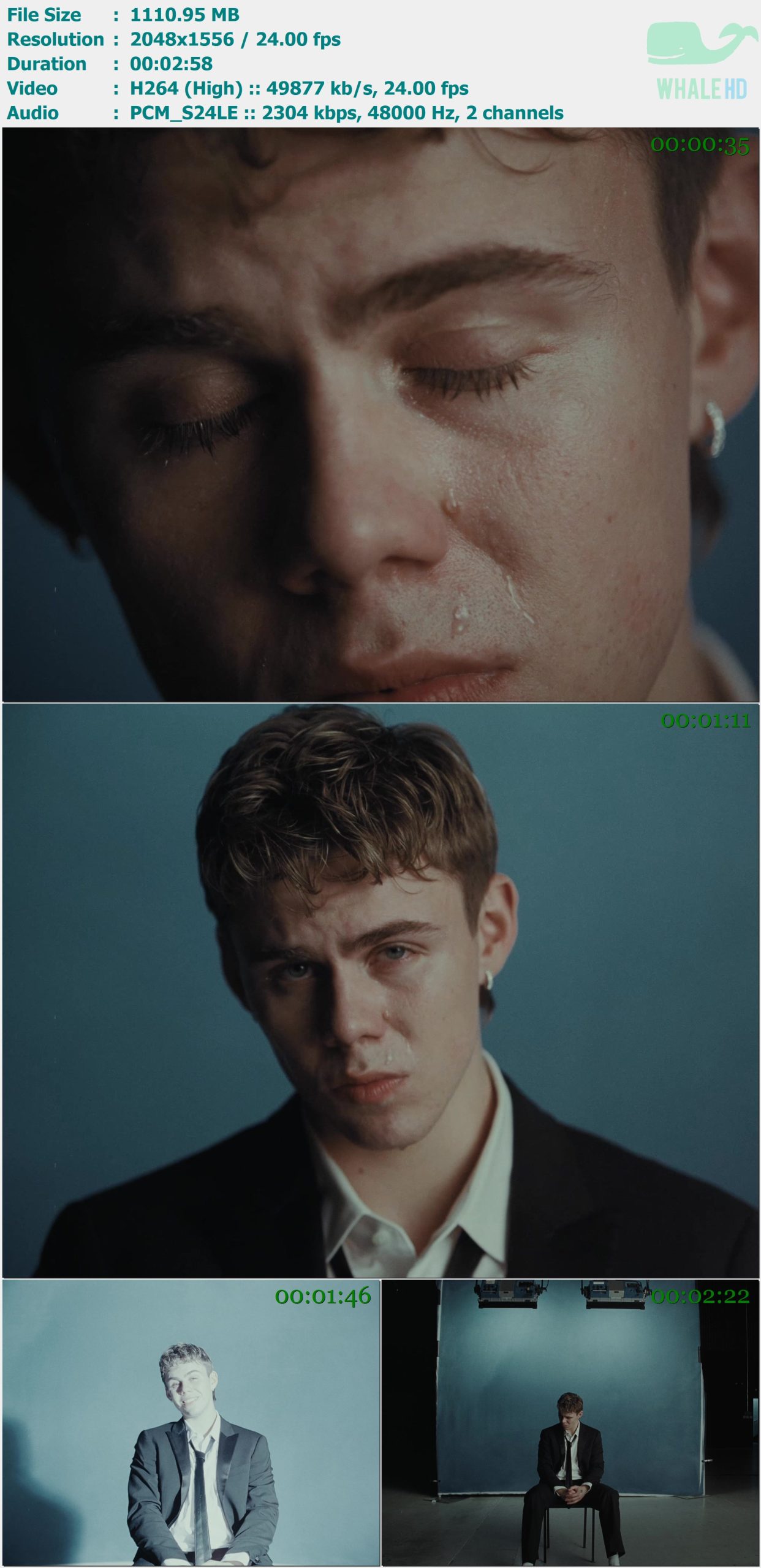 The Kid LAROI - A COLD PLAY 2025 MasterRip 1556p H264 - 1.08GB